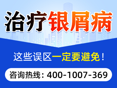 合肥有治银屑病的中医吗